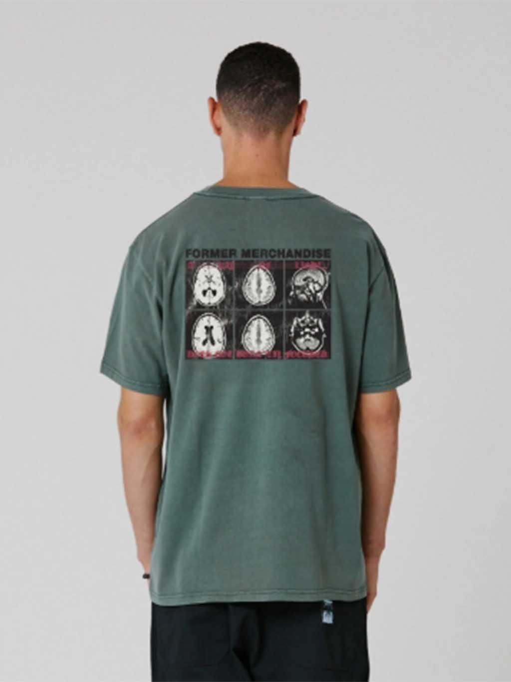 Former Men's Brain Scan Oversized Short Sleeve T-Shirt