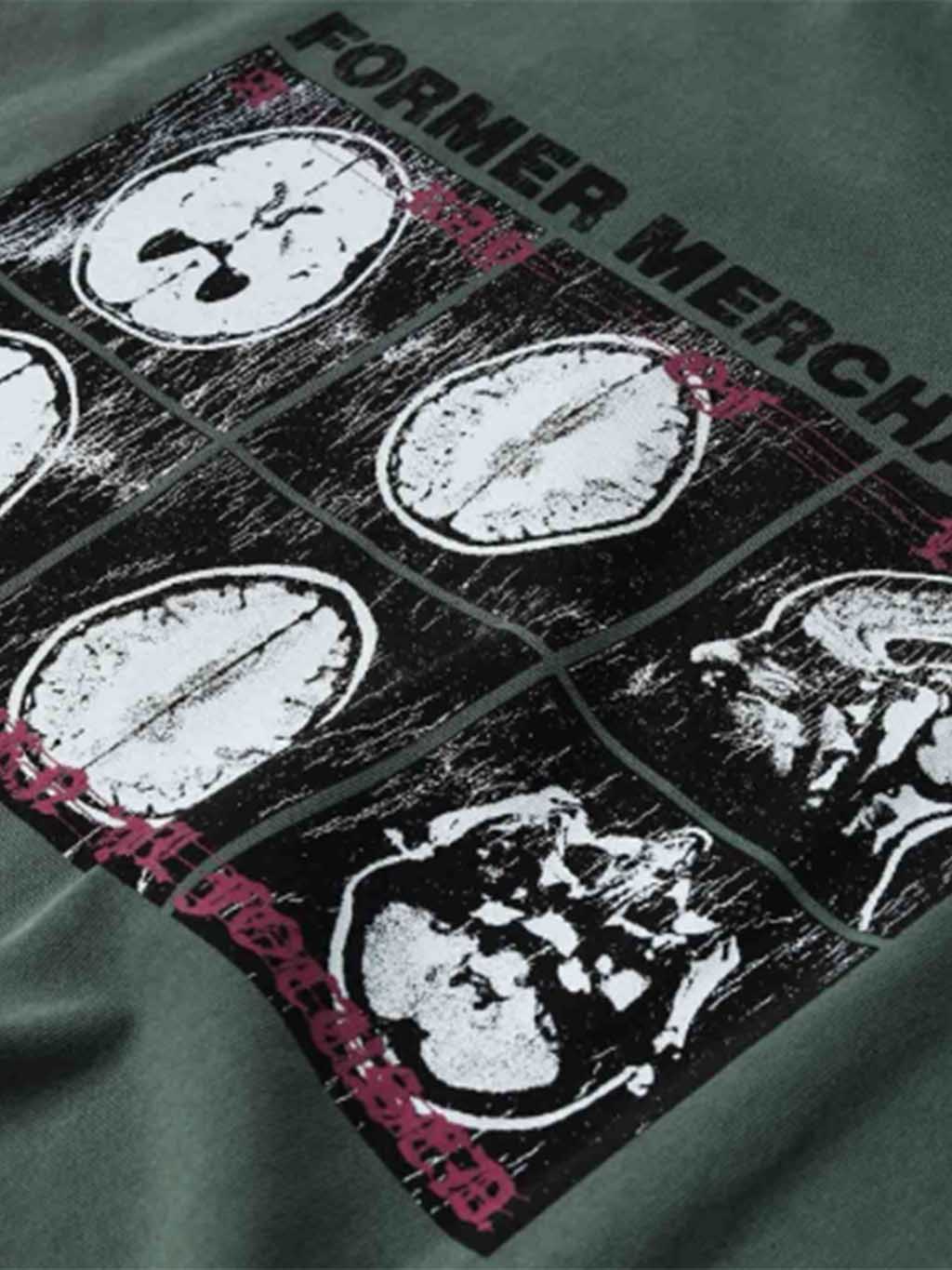 Former Men's Brain Scan Oversized Short Sleeve T-Shirt
